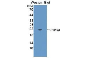 Western Blotting (WB) image for anti-Keratin 9 (KRT9) (AA 315-456) antibody (ABIN1864977) (KRT9 antibody  (AA 315-456))