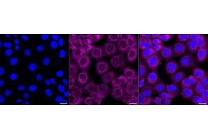Immunocytochemical staining of HT- cells with PSMA2 antibody (ABIN7800960), 1:1,000).