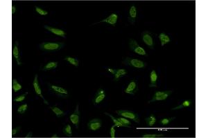 Immunofluorescence of monoclonal antibody to SFPQ on HeLa cell. (SFPQ antibody  (AA 269-361))