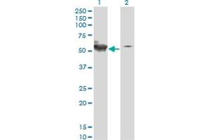 Western Blotting (WB) image for anti-serine/threonine Kinase 38 (STK38) (AA 1-465) antibody (ABIN7199720)