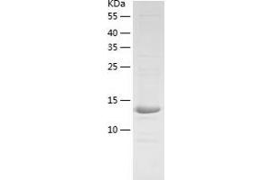 Western Blotting (WB) image for Processing of Precursor 5, Ribonuclease P/MRP Subunit (POP5) (AA 1-140) protein (His tag) (ABIN7284640) (POP5 Protein (AA 1-140) (His tag))