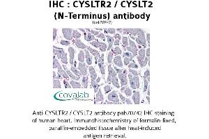 Image no. 3 for anti-Cysteinyl Leukotriene Receptor 2 (CYSLTR2) (N-Term) antibody (ABIN1733466) (CasLTR2 antibody  (N-Term))