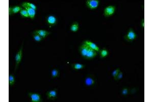 Immunofluorescence staining of HepG2 cells with ABIN7127382 at 1:60, counter-stained with DAPI. (Recombinant Caspase 9 antibody)