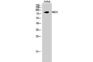 Western Blotting (WB) image for anti-MYST Histone Acetyltransferase 2 (MYST2) (Internal Region) antibody (ABIN3175459) (MYST2 antibody  (Internal Region))