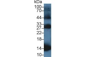 Western Blot; Sample: Rat Blood Cells lysate; Primary Ab: 1µg/ml Rabbit Anti-Equine HBb Antibody Second Ab: 0. (Hemoglobin Subunit beta antibody  (AA 1-147))