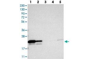 Western blot analysis of Lane 1: RT-4, Lane 2: U-251 MG, Lane 3: Human Plasma, Lane 4: Liver, Lane 5: Tonsil with GGCT polyclonal antibody . (GGCT antibody)
