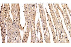 Detection of MYH2 in Mouse Cardiac Muscle Tissue using Polyclonal Antibody to Myosin Heavy Chain 2 (MYH2) (MYH2 antibody  (AA 1238-1472))