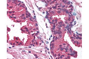 Anti-AKT1 antibody IHC of human prostate. (AKT1 antibody  (AA 121-170))