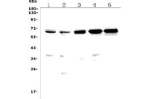 Western blot analysis of Tnfrsf8 using anti-Tnfrsf8 antibody (ABIN7600685).