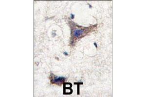 Formalin-fixed and paraffin-embedded human brain tissue reacted with SPRED1 polyclonal antibody  , which was peroxidase-conjugated to the secondary antibody, followed by DAB staining. (SPRED1 antibody  (C-Term))
