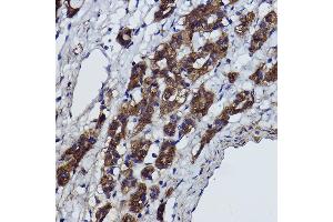 Immunohistochemistry of paraffin-embedded Rat heart using α-Smooth Muscle Actin  Rabbit pAb (ABIN6127402, ABIN6136473, ABIN6136476 and ABIN6214239) at dilution of 1:25 (40x lens).