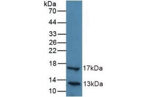 Detection of Recombinant LIPC, Human using Polyclonal Antibody to Lipase, Hepatic (LIPC) (LIPC antibody  (AA 347-478))