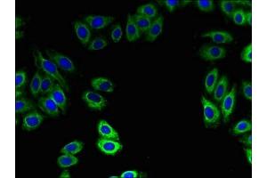 ZDHHC15 antibody  (AA 239-337)