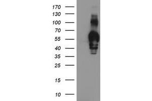Western Blotting (WB) image for anti-Golgi Membrane Protein 1 (GOLM1) antibody (ABIN1498496) (GOLM1 antibody)