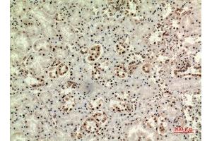 Immunohistochemistry (IHC) image for anti-WD Repeat Domain 83 (wdr83) (Internal Region) antibody (ABIN6281359)