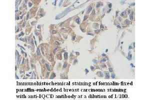 Image no. 1 for anti-IQ Motif Containing D (IQCD) antibody (ABIN1577297) (IQCD antibody)