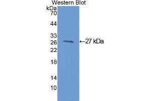 Western blot analysis of the recombinant protein. (GSTM1 antibody  (AA 1-218))