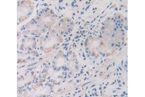 Figure. (TMPRSS2 antibody  (AA 284-492))