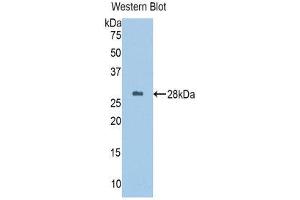Western Blotting (WB) image for anti-alpha-1-B Glycoprotein (A1BG) (AA 313-513) antibody (ABIN1857839)