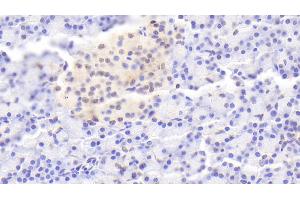 Detection of IL1RA in Human Pancreas Tissue using Polyclonal Antibody to Interleukin 1 Receptor Antagonist (IL1RA) (IL1RN antibody  (AA 26-177))