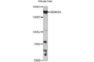 Western blot analysis of extracts of mouse liver, using SEMA5A antibody. (SEMA5A antibody)