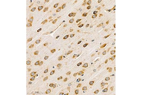 NKA antibody