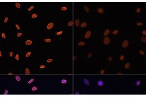Immunofluorescence analysis of NIH/3T3 cells using Acetyl-Histone H4-K12 Polyclonal Antibody at dilution of 1:100. (Histone H4 antibody  (acLys12))