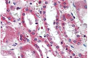 Human Kidney (formalin-fixed, paraffin-embedded) stained with SIRT5 antibody ABIN290374 at 5 ug/ml followed by biotinylated goat anti-rabbit IgG secondary antibody ABIN481713, alkaline phosphatase-streptavidin and chromogen. (SIRT5 antibody  (AA 30-46))
