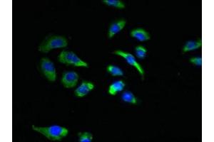 Immunofluorescent analysis of A549 cells using ABIN7170048 at dilution of 1:100 and Alexa Fluor 488-congugated AffiniPure Goat Anti-Rabbit IgG(H+L) (NKAIN4 antibody  (AA 83-150))