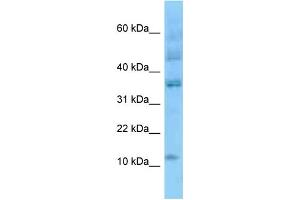 WB Suggested Anti-ID3 Antibody Titration: 1. (ID3 antibody  (N-Term))