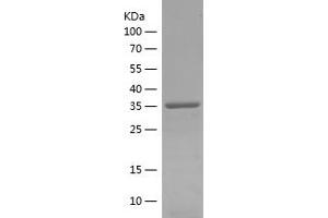 Western Blotting (WB) image for Caprin Family Member 2 (CAPRIN2) (AA 377-595) protein (His tag) (ABIN7282043) (CAPRIN2 Protein (AA 377-595) (His tag))