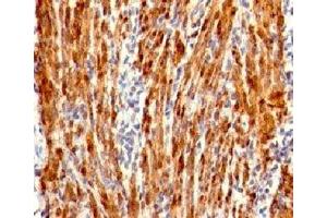 Formalin-fixed, paraffin-embedded human uterus stained with Calponin antibody (RMCN1-1). (Recombinant Calponin antibody)