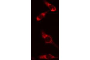 ABIN6274166 staining HeLa cells by IF/ICC. (HARS1/Jo-1 antibody  (C-Term))