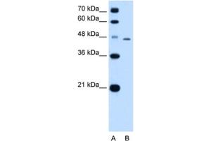 Western Blotting (WB) image for anti-TAP Binding Protein (Tapasin) (TAPBP) antibody (ABIN2462853) (TAPBP antibody)