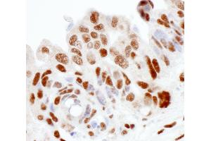 Immunohistochemistry (IHC) image for anti-Sjogren Syndrome Antigen B (SSB) (AA 358-408) antibody (ABIN7453946) (SSB antibody  (AA 358-408))