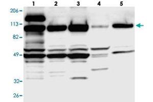 Western blot analysis of Lane 1: RT-4, Lane 2: U-251 MG, Lane 3: A-431, Lane 4: Liver, Lane 5: Tonsil with SMEK1 polyclonal antibody .
