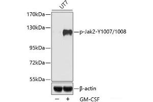 Western blot analysis of extracts of UT7 cells using Phospho-Jak2(Y1007/1008) Polyclonal Antibody.