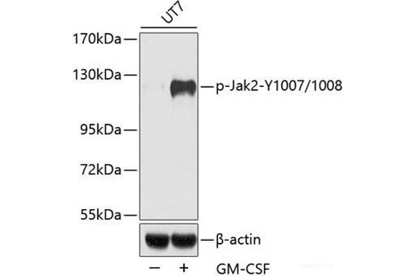 JAK2 抗体  (pTyr1007, pTyr1008)