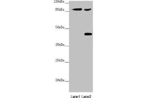 Western blot All lanes: SPICE1 antibody at 5.