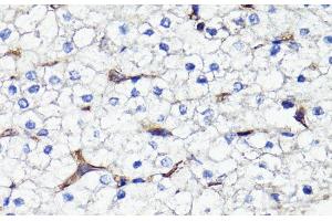 Immunohistochemistry of paraffin-embedded Human liver using CD44 Polyclonal Antibody at dilution of 1:100 (40x lens). (CD44 antibody)
