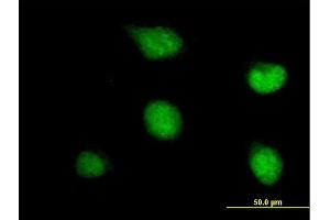 Immunofluorescence of purified MaxPab antibody to ZNF278 on HeLa cell.