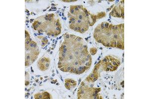 Immunohistochemistry of paraffin-embedded human stomach using IGFBP4 Antibody. (IGFBP4 antibody  (AA 22-258))