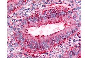 Anti-DPP8 antibody IHC of human uterus, endometrial glands. (DPP8 antibody  (Internal Region))