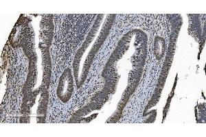 IHC analysis of HNRNPH3 using anti-HNRNPH3 antibody (ABIN7601121). (HNRNPH3 antibody  (AA 29-268))