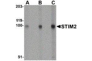 Western Blotting (WB) image for anti-Stromal Interaction Molecule 2 (Stim2) (Center) antibody (ABIN2476610) (Stim2 antibody  (Center))