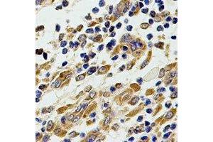 Immunohistochemical analysis of Chitotriosidase staining in human stomach formalin fixed paraffin embedded tissue section. (Chitotriosidase 1 antibody)