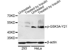 Western blot analysis of extracts of 293 and HeLa cells, using Phospho-GSK3A-S21 antibody. (GSK3 alpha antibody  (pSer21))