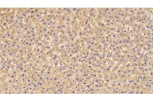 Detection of PALB in Rat Liver Tissue using Polyclonal Antibody to Prealbumin (PALB) (TTR antibody  (AA 20-147))