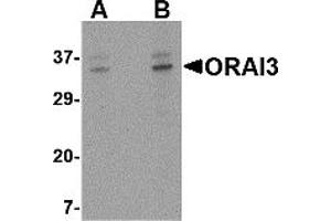 Western Blotting (WB) image for anti-ORAI Calcium Release-Activated Calcium Modulator 3 (ORAI3) (C-Term) antibody (ABIN1030564) (ORAI3 antibody  (C-Term))