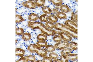Immunohistochemistry of paraffin-embedded mouse kidney using NQO1 antibody (ABIN7268795) at dilution of 1:100 (40x lens). (NQO1 antibody)